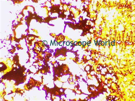 Microscope World Blog: Tuberculosis under the Microscope