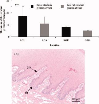 Stratum germinativum – the stratum germinativum (A) in comparison at... | Download Scientific ...