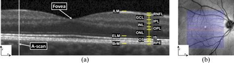 Retinal layer segmentation of macular OCT images - IACL