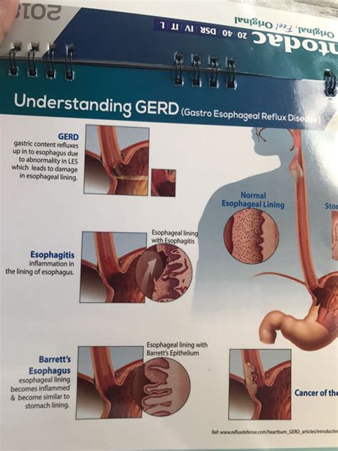 GI Endoscopy