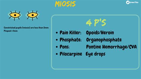 Miosis - Symptoms, Causes & Treatment - Santripty