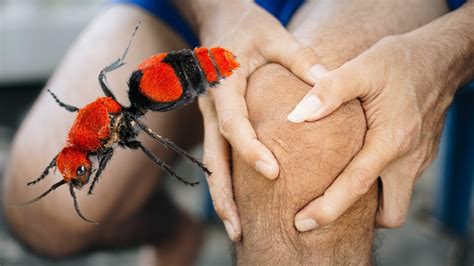 'Cow Killer' Ant Leaves Florida Man With Nasty Bite, 'Excruciating' Pain | iHeart