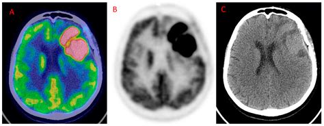 Pet Brain Scan