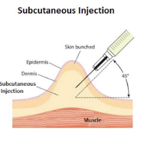 Subcutaneous Injection: Understanding the Basics - TruTanMT2