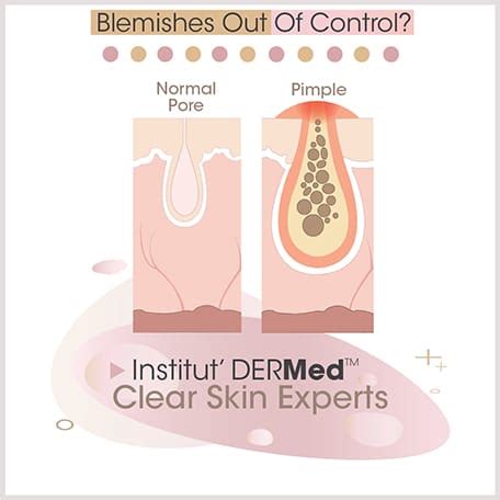 Oily Acne Skin Disorders Explained – Institut Dermed