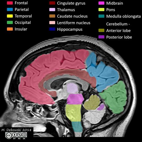 Brain Lobes – Telegraph