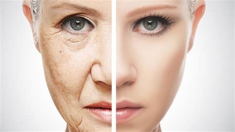 How To Reduce Wrinkles Naturally - YouTube