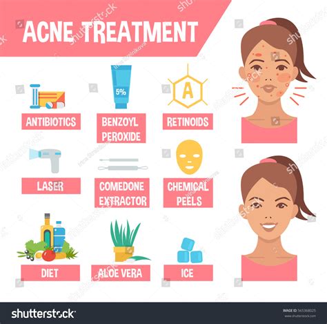 Acne Treatment Procedures Acne Infographic Elements Stock Illustration ...