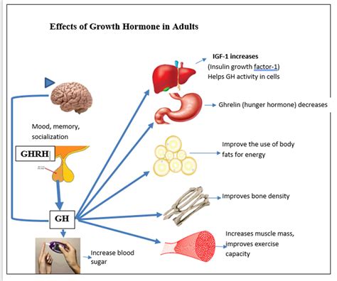 Adult Growth Hormone Deficiency - WAPO