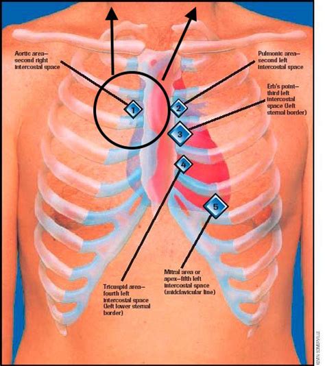 Guide To Heart Murmurs: Aortic Stenosis Murmur - Stepwards