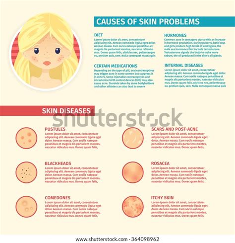 Infographics Skin Problems Causes Problem Skin Stock Vector (Royalty ...