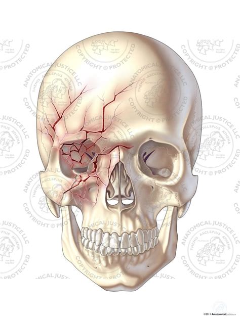 Anterior Skull Fracture