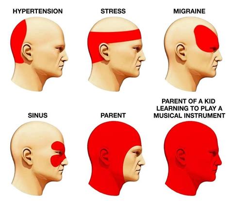 Different Types of Headaches That You May Know - The Kitchensurvival