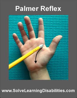 Retained Palmar Reflex or Grasp Reflex - Solve Learning Disabilities