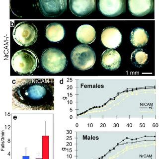 Cataract histology of NrCAM-deficient mice. From the emergence of... | Download Scientific Diagram