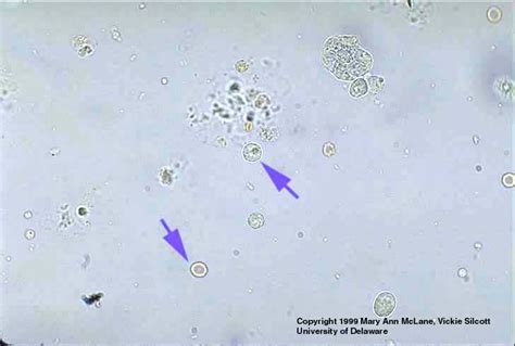 RBC and WBC in Urine Sediment | Urinal, Wbc, Sediment