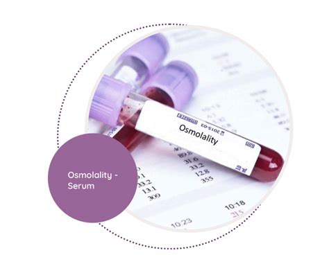 Osmolality - Serum - MediScan Lab