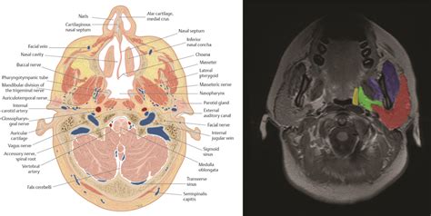 17 Neck Soft Tissue | Radiology Key