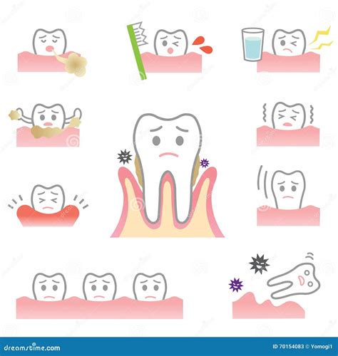 Periodontal Disease Stock Vector - Image: 70154083