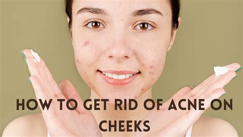 How To Get Rid Of Acne On Cheeks - Healthinline