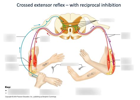 Diagram of Crossed extensor reflex - with reciprocal inhibition | Quizlet