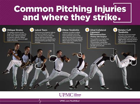 Common Baseball Pitching Injuries & Where They Strike