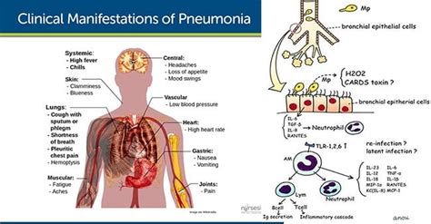 Pathogenesis and Clinical Manifestations of Mycoplasma pneumoniae