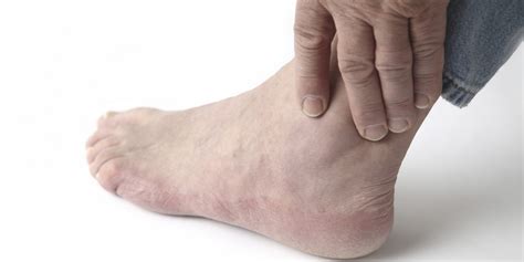 Chronic Lateral Ankle Instability | HuffPost