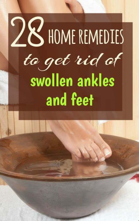 Home Remedy Hacks • 28 Home Remedies For Feet And Ankle Swelling