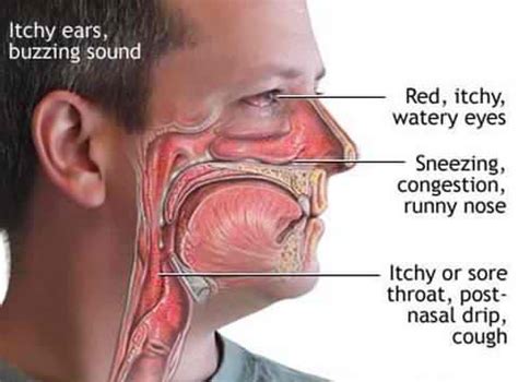 Itchy Throat - Remedies, Symptoms, Causes, Treatment