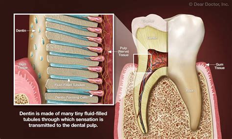 Tooth Pain | Dental Innovations | Mark D. Shirley, DDS | Oklahoma City Oklahoma