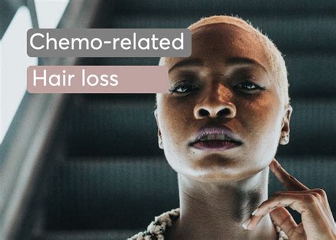 Chemotherapy related hair loss - Best treatments | MDhair