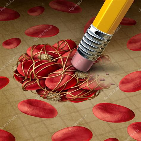 Blood Clot Treatment — Stock Photo © lightsource #101392272