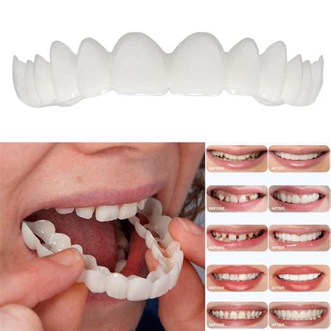 Silicone Smile Teeth Cosmetic Veneers Dentistry Dental Snap On Comfort Covers | eBay