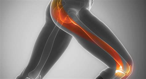 What Really Causes IT Band Syndrome Pain (And How Do You Fix It)? | Ascent Chiropractic