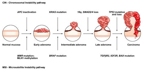 Cancers | Free Full-Text | The Molecular Hallmarks of the Serrated Pathway in Colorectal Cancer