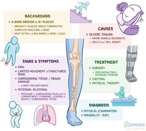 Comminuted Fracture: What Is It, Examples, and More | Osmosis