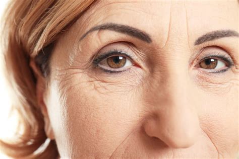 Fine Lines & Wrinkles | Facial Aesthetics