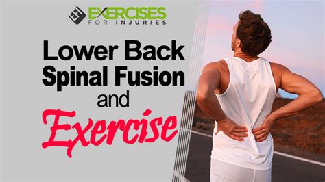 Lower Back Spinal Fusion and Exercise (Webinar)