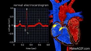 ECG Animation - Electrical Changes in Heart on Make a GIF