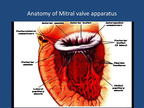 PPT - Mitral valve disease – Mitral Regurgitation PowerPoint ...