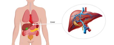 Liver Surgery / Hepatectomy / Liver Resection - Harbour Surgery Centre