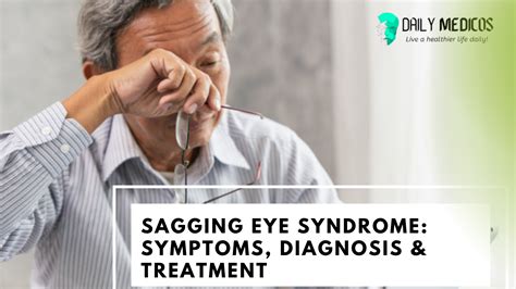 Sagging Eye Syndrome: Causes, Symptoms, Diagnosis & Treatment - Daily Medicos