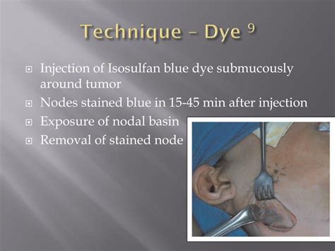 Sentinel lymph node biopsy - orthopadi