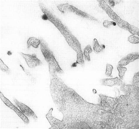 Microvilli projecting into the perivitelline space between the oocyte... | Download Scientific ...