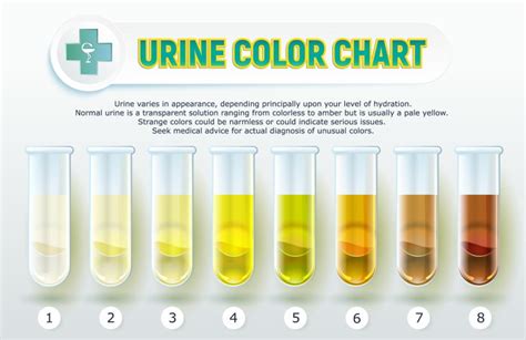 Is Brown Urine a Cause For Concern? Yes, Sometimes