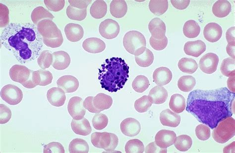 Hematopathology