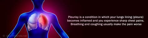 Pleurisy - Causes, Symptoms, Diagnosis, Treatment