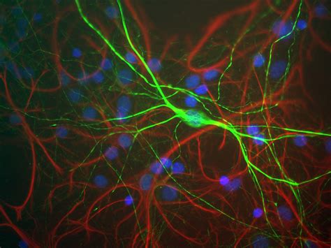 Neurofilament Proteins