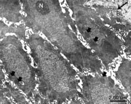 Electron microscopic image of basal cells of the epidermis showing... | Download Scientific Diagram